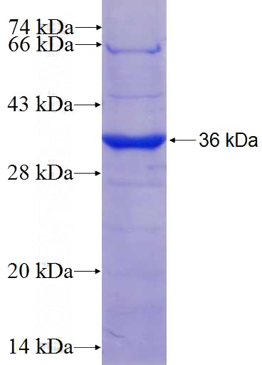 Recombinant Human NR1H3 SDS-PAGE