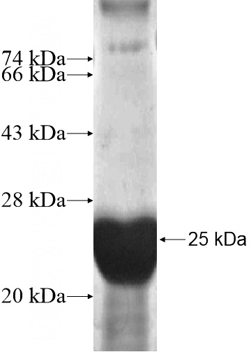 Recombinant Human CRYGS SDS-PAGE