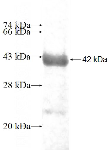 Recombinant Human DNASE2 SDS-PAGE