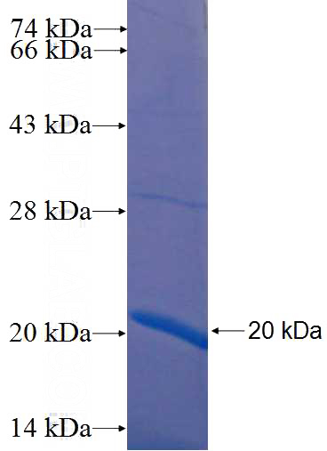 Recombinant Human SLC10A5 SDS-PAGE