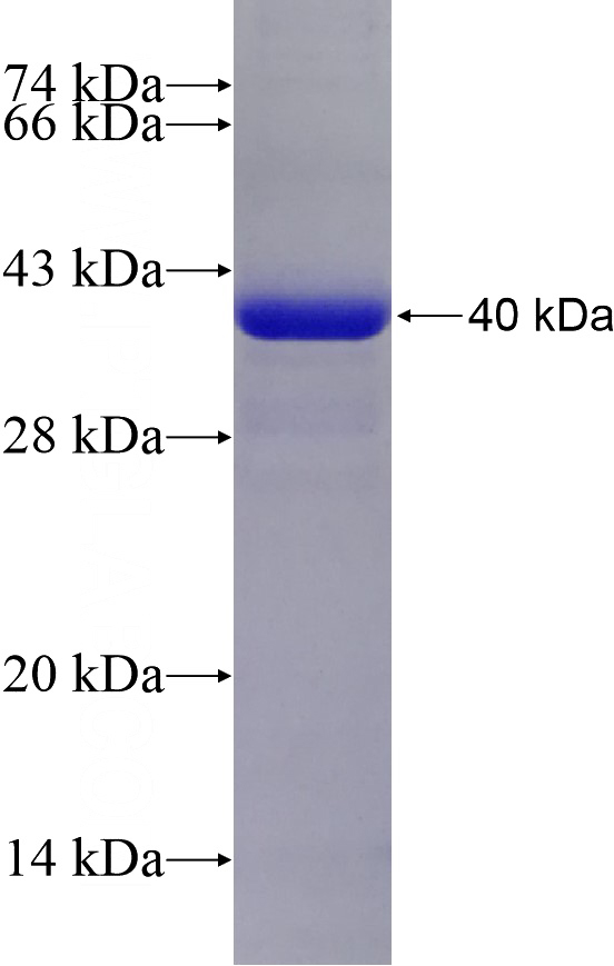 Recombinant Human STRN3 SDS-PAGE