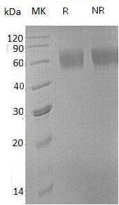Human AMIGO2/ALI1 (His tag) recombinant protein