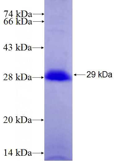 Recombinant Human DPP6 SDS-PAGE