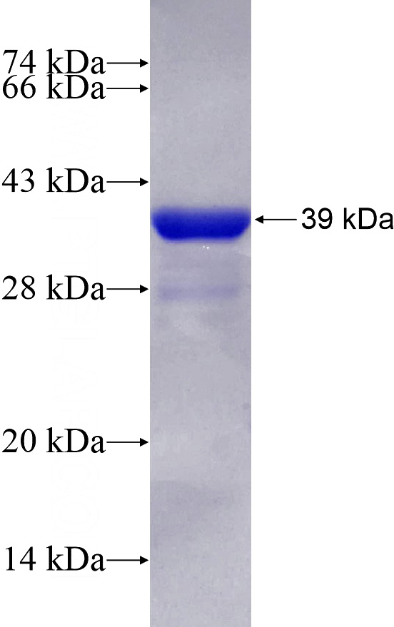 Recombinant Human LSDP5 SDS-PAGE