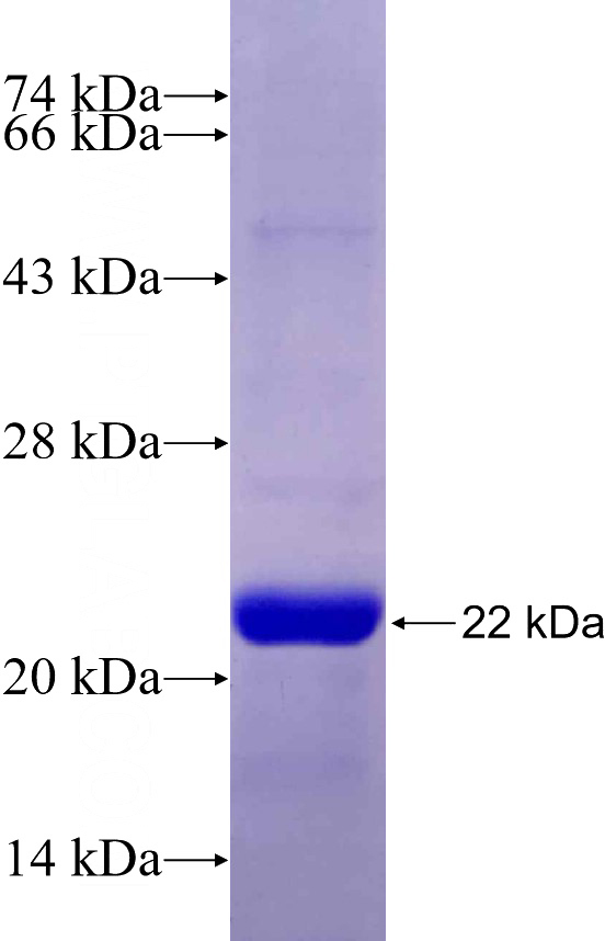 Recombinant Human ANK3 SDS-PAGE