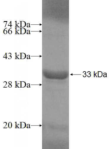 Recombinant Human ADHFE1 SDS-PAGE