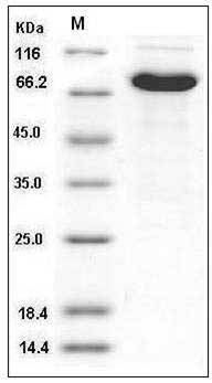 Human CD4 / LEU3 Protein (His & Fc Tag) SDS-PAGE