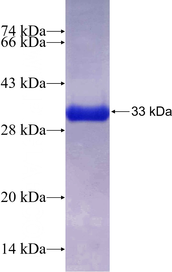 Recombinant Human DYNLRB1 SDS-PAGE