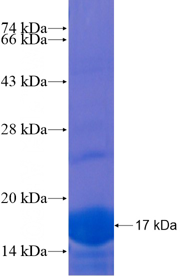Recombinant Human FLYWCH2 SDS-PAGE