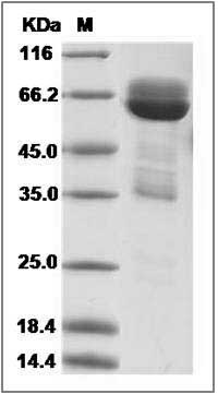 Rat CADM3 / NECL1 / IGSF4B Protein (Fc Tag) SDS-PAGE