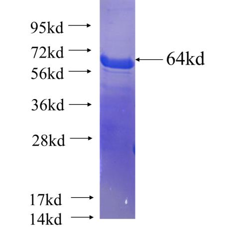 Recombinant human TET2 SDS-PAGE
