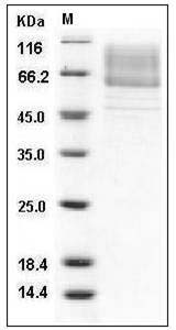 Mouse LIMP-2 / SCARB2 / CD36L2 Protein (His Tag) SDS-PAGE