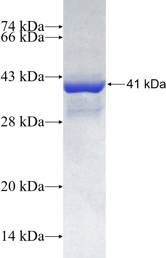 Recombinant Human PFKFB4 SDS-PAGE