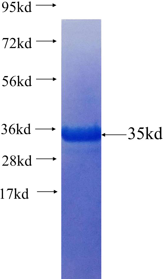 Recombinant Human SH3GL1 SDS-PAGE