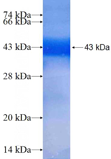 Recombinant Human TBC1D20 SDS-PAGE