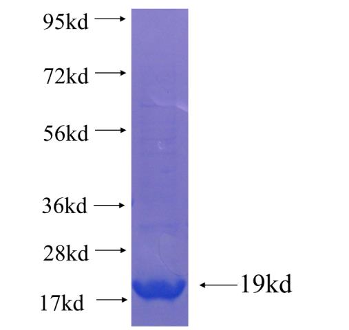 Recombinant human CXorf61(Full length) SDS-PAGE
