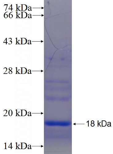 Recombinant Human FAM26E SDS-PAGE