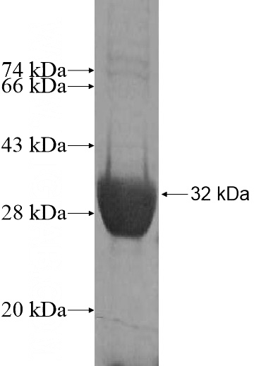 Recombinant Human FBXL5 SDS-PAGE