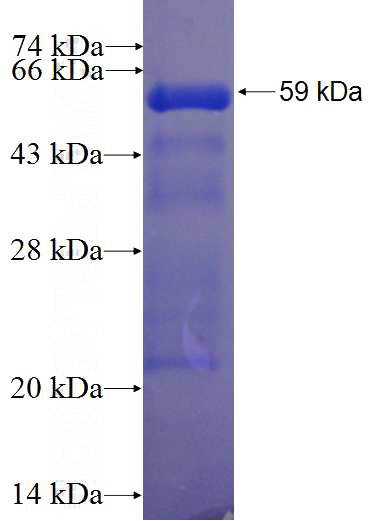 Recombinant Human RNF34 SDS-PAGE