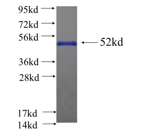 Recombinant human RBM25 SDS-PAGE