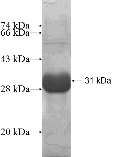 Recombinant Human RAB27A SDS-PAGE