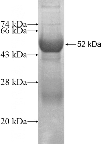 Recombinant Human EXOG SDS-PAGE