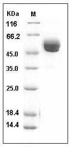Human NCR3 / NKp300 Protein (His & Fc Tag) SDS-PAGE