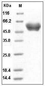 Human SerpinA1 / A1AT Protein (His Tag) SDS-PAGE