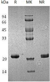 Human HPCAL1/BDR1 (His tag) recombinant protein
