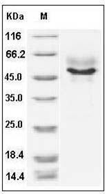 Human Syndecan-1 / SDC1 / CD138 Protein (His Tag) SDS-PAGE