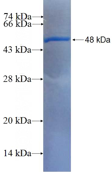 Recombinant Human APOB SDS-PAGE