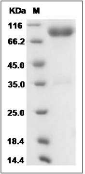 Mouse IL1R2 / CD121b Protein (Fc Tag) SDS-PAGE
