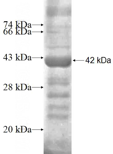 Recombinant Human HPS1 SDS-PAGE