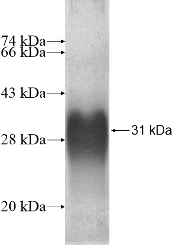 Recombinant Human KCNC4 SDS-PAGE
