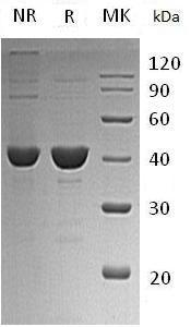 Human UROD (His tag) recombinant protein