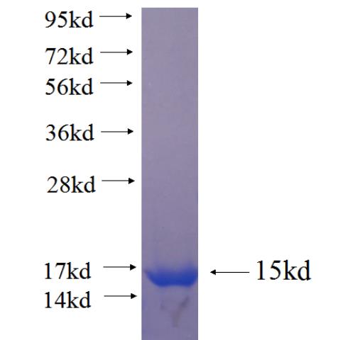Recombinant human L3MBTL4 SDS-PAGE