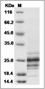 Human Fas Ligand / FASLG / CD95L Protein (His Tag) SDS-PAGE