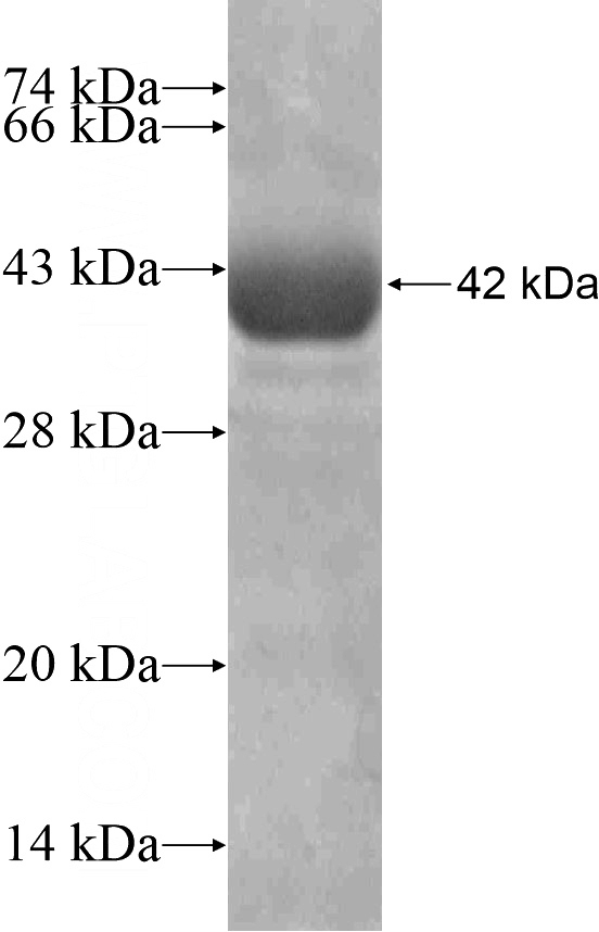 Recombinant Human KIAA1586 SDS-PAGE