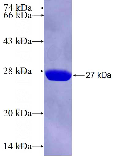 Recombinant Human PIK3CD SDS-PAGE