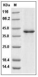 Human CXCL12 / SDF1b Protein (Fc Tag) SDS-PAGE
