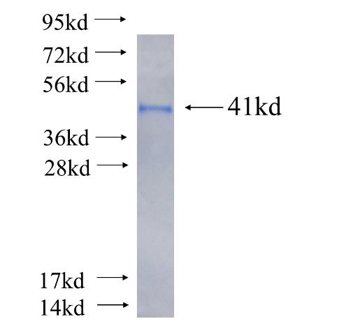 Recombinant human SEPT9 SDS-PAGE