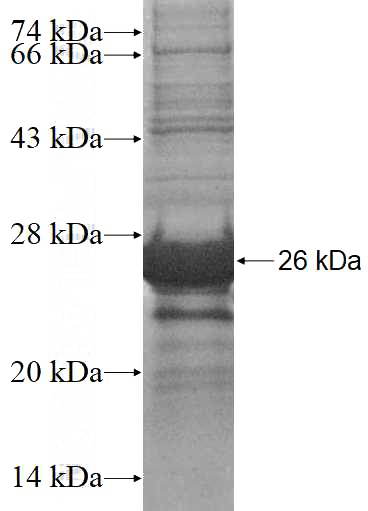Recombinant Human KLHL4 SDS-PAGE