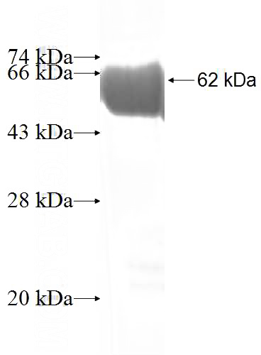 Recombinant Human RLBP1 SDS-PAGE
