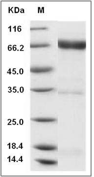 Human NRG1-beta 1 Protein (Fc Tag) SDS-PAGE