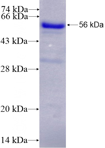 Recombinant Human MIER2 SDS-PAGE