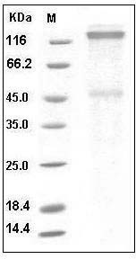 Human IGF1R / CD221 Protein (His Tag) SDS-PAGE