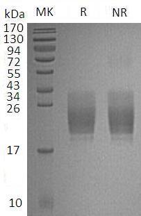 Mouse Cd160/mCG_14869 (His tag) recombinant protein