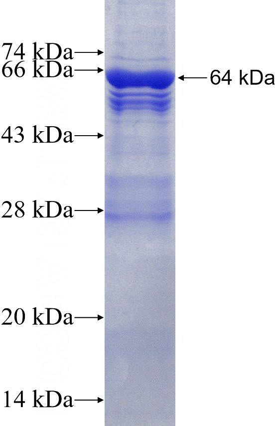 Recombinant Human CBS SDS-PAGE