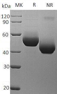 Mouse Il5ra/Il5r (His tag) recombinant protein