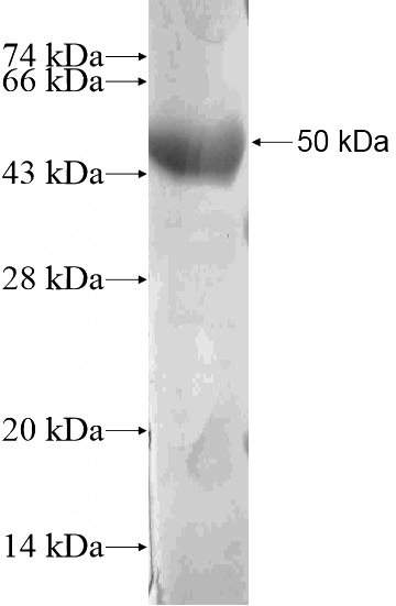 Recombinant Human KIAA1712 SDS-PAGE